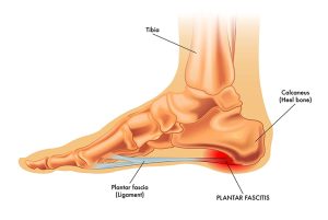 [TBTS] CME Chủ đề Đột quỵ & liệt nửa người